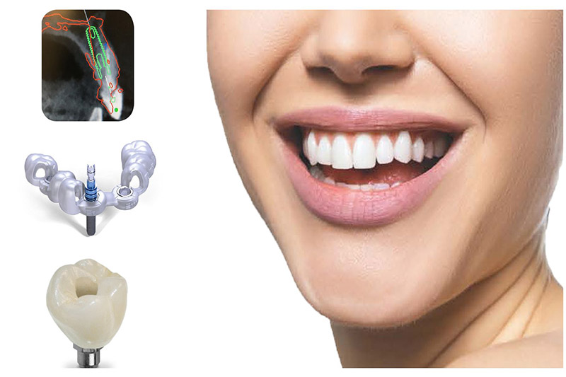 برنامه‌ریزی-دقیق-درمان-با-نرم‌افزارهای-پیشرفته