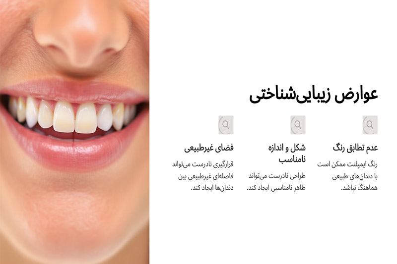 عوارض-زیبایی-شناختی-ایمپلنت-دیجیتال