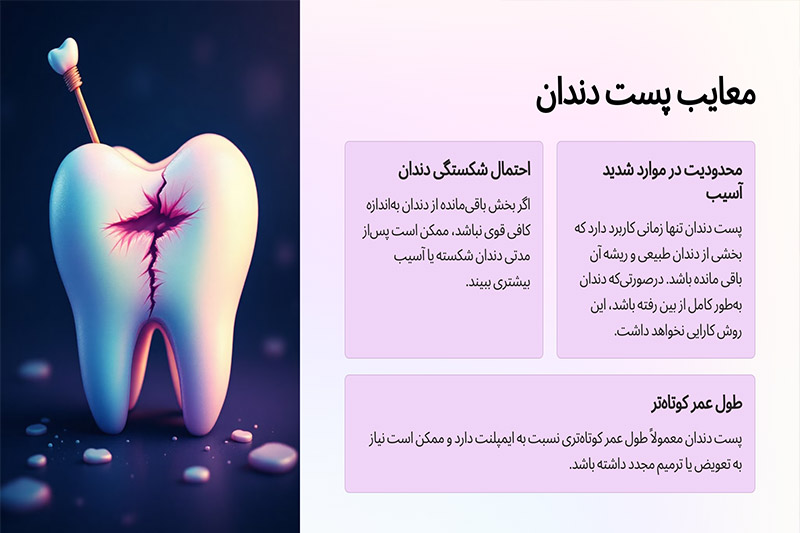 معایب-پست-دندان