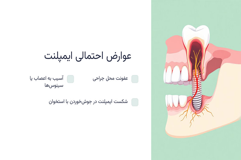 عوارض-ایمپلنت-دندان