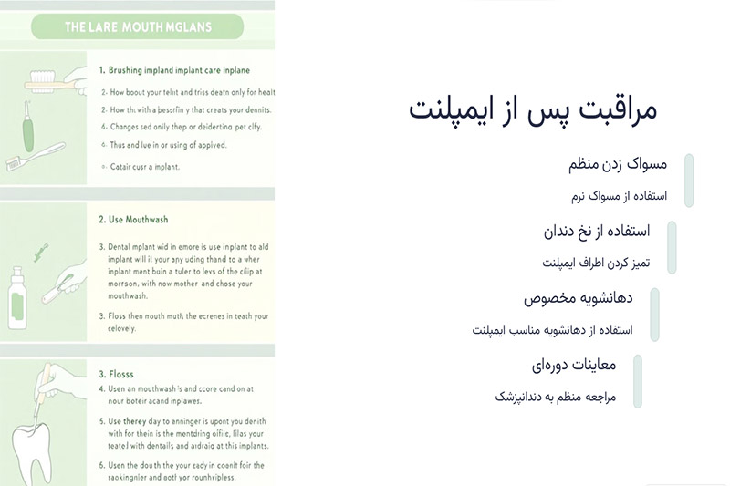 مراقبت-از-ایمپلنت-