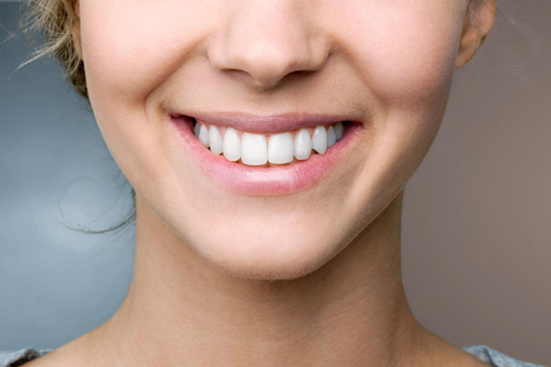 مراقبت-های-بعد-از-کامپوزیت-دندان 