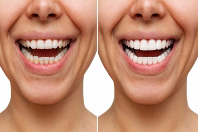 نصب-نهایی-لمینت‌ها