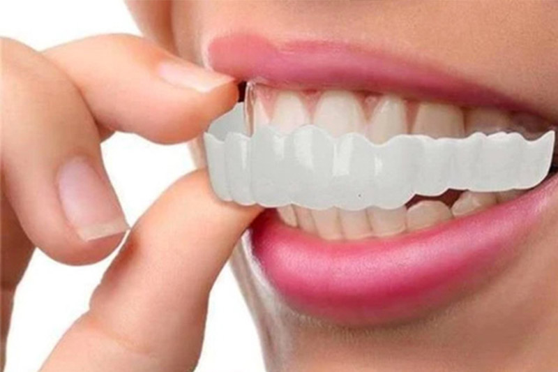 لمینت-متحرک-دندان-چیست