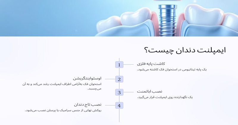 ایمپلنت دندان چیست و چه کاربردی دارد